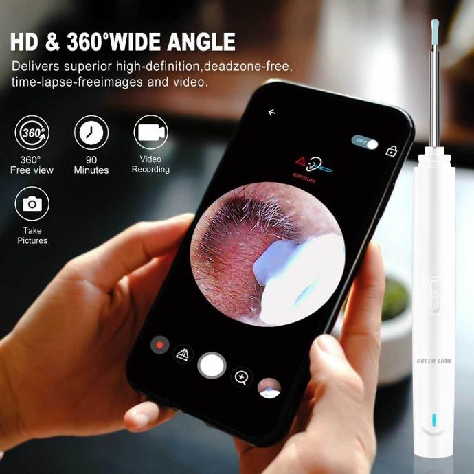 Visual Earwax Removal Tool